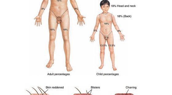 5章&nbsp;皮膚系統(tǒng)
