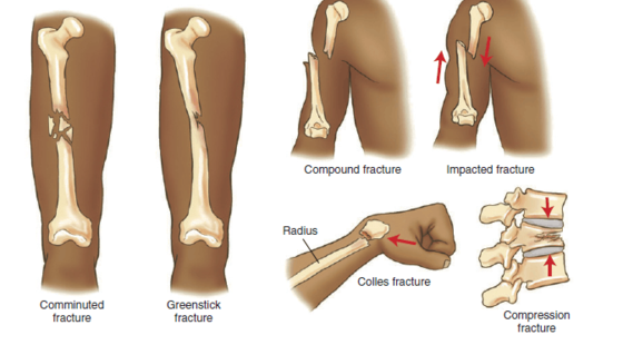 10章&nbsp;肌肉骨骼系統(tǒng)