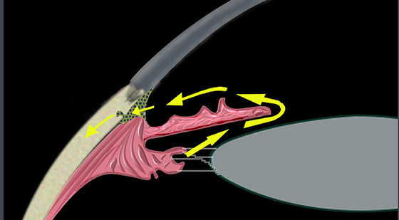 添翼ISPN/RN專業(yè)課&nbsp;65章&nbsp;眼耳科用藥