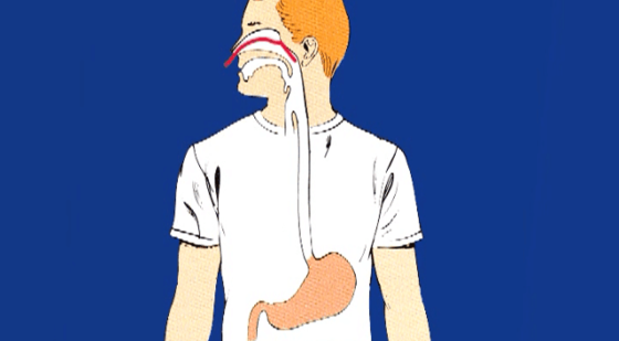 添翼2017-2018年ISPN/RN專業(yè)課&nbsp;20章&nbsp;管道護(hù)理