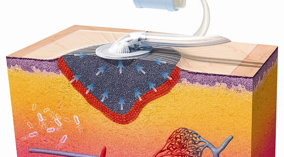 添翼ISPN/RN專業(yè)課46章&nbsp;成人皮膚系統(tǒng)疾病